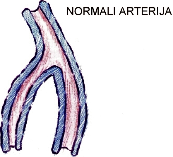 normali